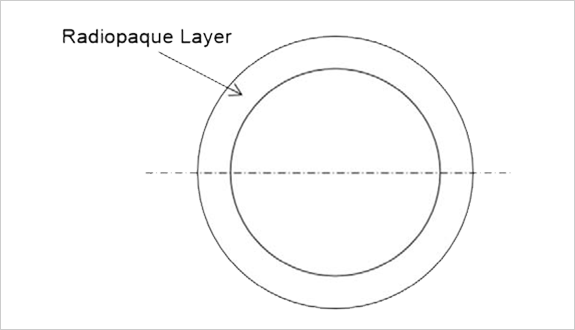 All radiopaque layer